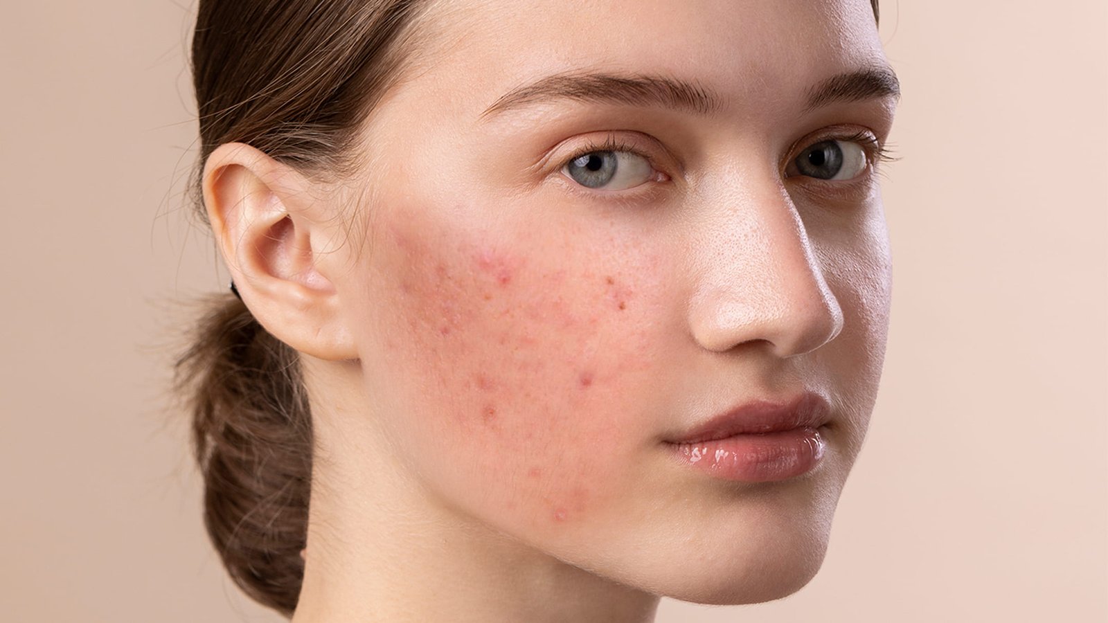 Before And After Using Natural Products